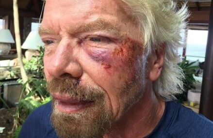 Billionaire Richard Branson survives bike crash