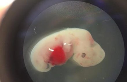 Scientists take first steps to growing human organs in pigs